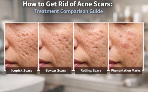 How to Get Rid of Acne Scars: The Complete Science-Backed Guide (2026)